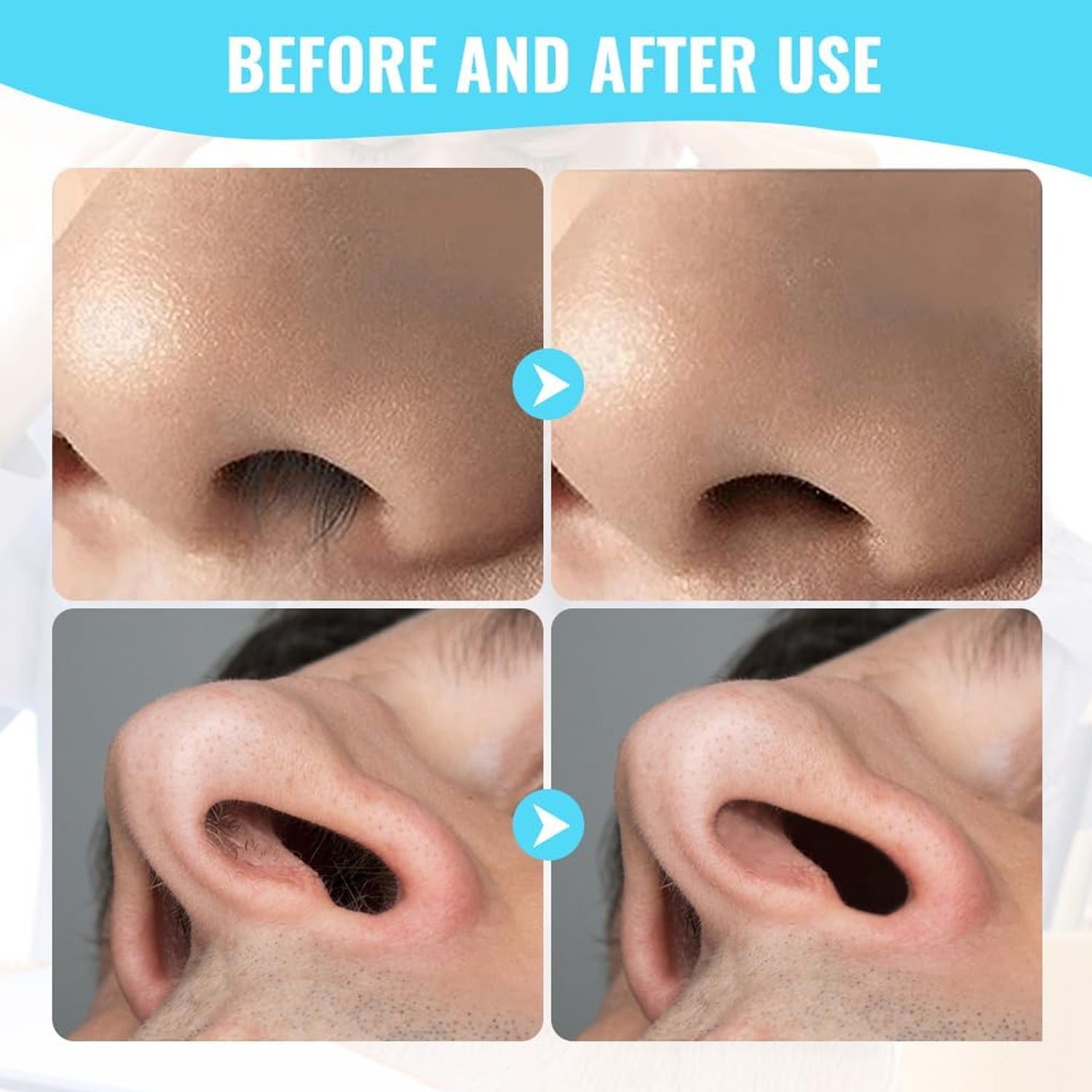 Nose Hair Removal Trimmer Nose Hair Remover Razor Kit Blade (3 Pcs Set) Nose Hair Removal Trimmer Nose Hair Remover Razor Kit Blade (3 Pcs Set)